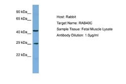 RAB40C Antibody, Novus Biologicals 100 &mu;L; Unconjugated:Antibodies,